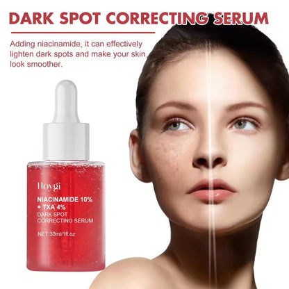 Dark Spot Repair Serum – Fades Pigmentation & Age Spots, Brightens Skin