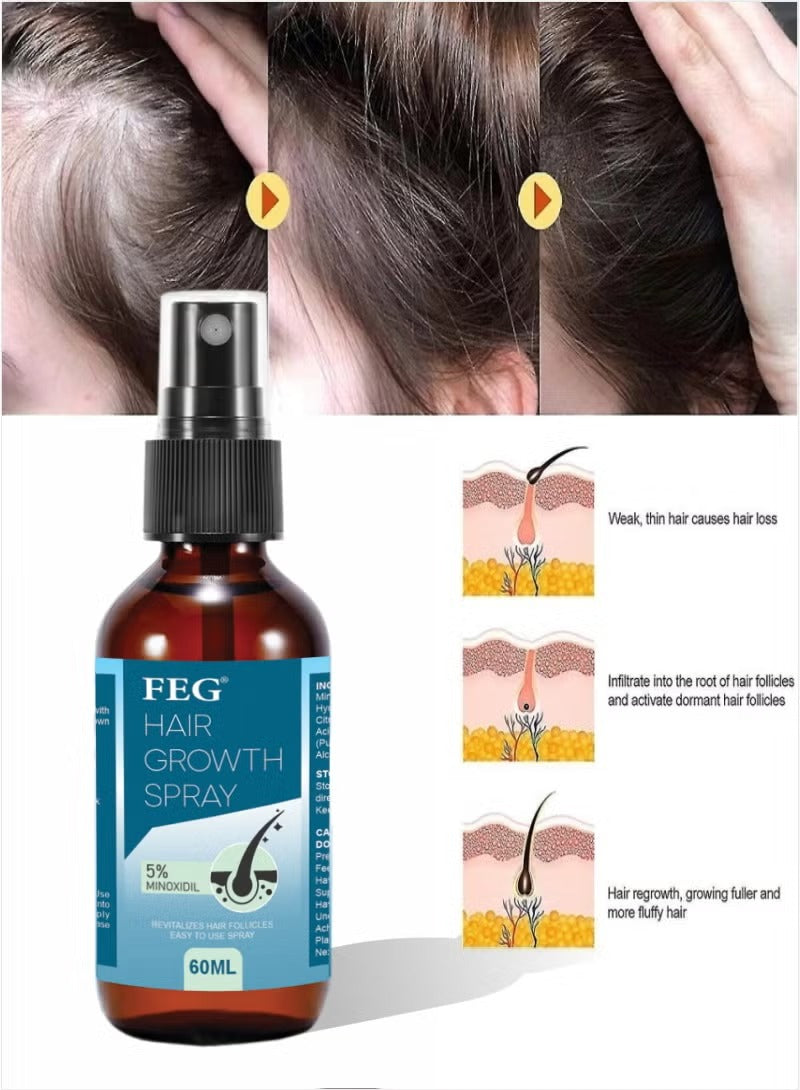 Hair Growth Spray & Beard Roller  – 5% Minoxidil Serum for Hair & Beard Growth
