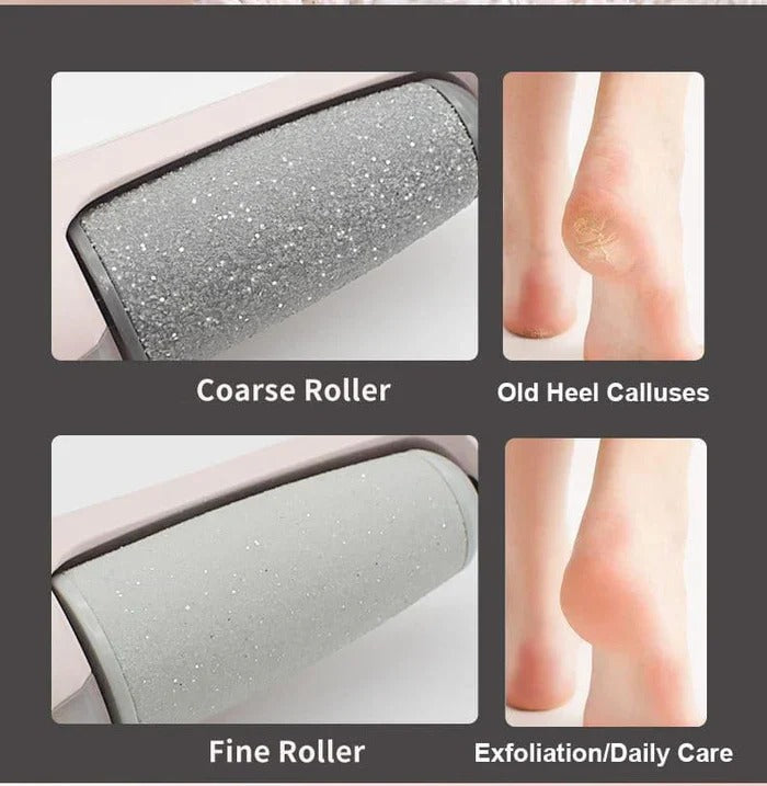 Rechargeable Foot Callus Remover