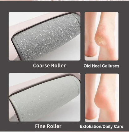 Rechargeable Foot Callus Remover