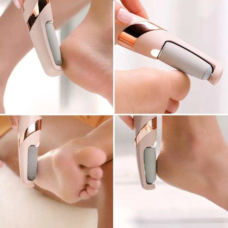 Rechargeable Foot Callus Remover